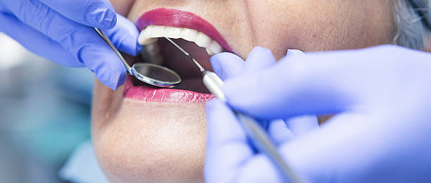 Best Emergency Dental Care for Abscessed Tooth in Crystal Lake, FL